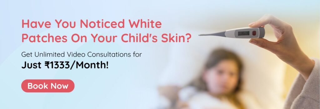 White Patches On Baby Skin
