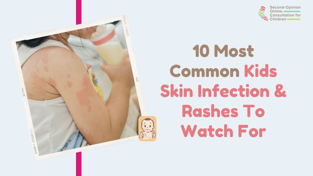 10 Most Common Kids Skin Infection & Rashes To Watch For